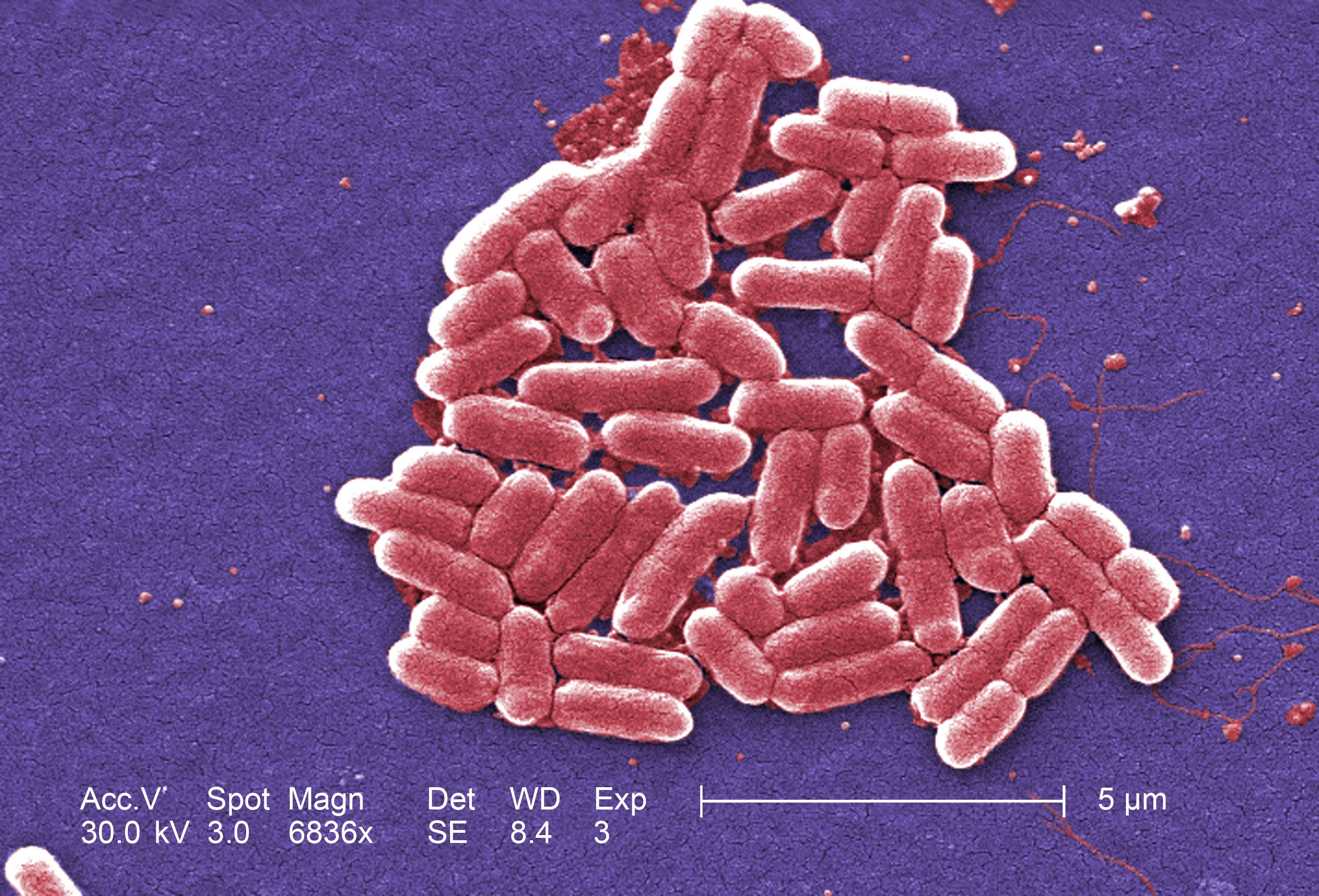 Under a high magnification of 6836X, digitally-colorized, scanning electron microscopic (SEM) image of Escherichia coli cluster | Photo: Janice Haney Carr